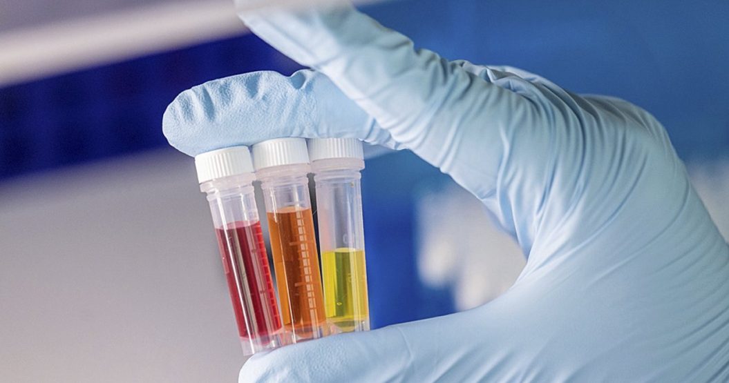 In Vitro Diagnostics